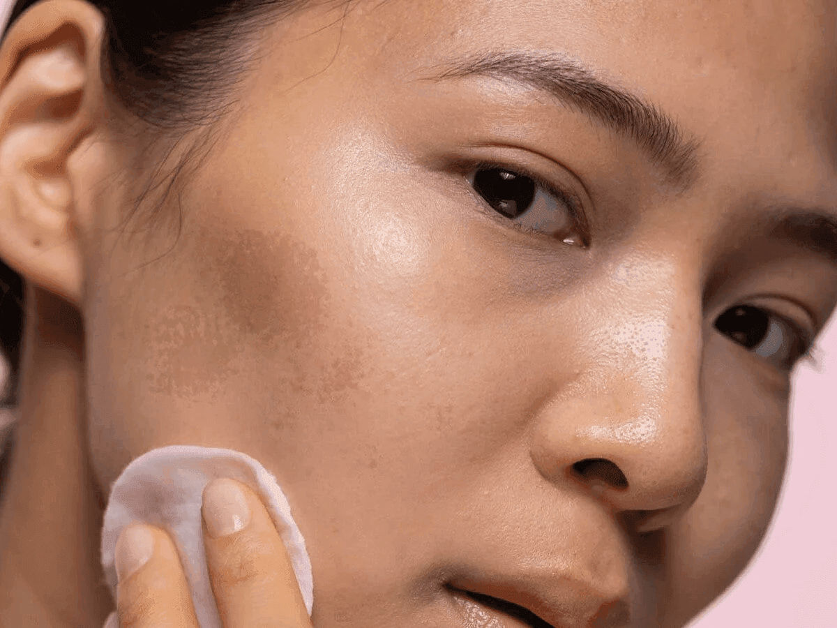 PDRN treatment for skin brightening